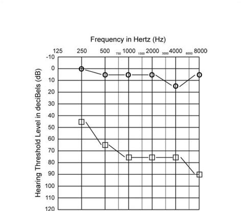 physiologic hearing tests.
